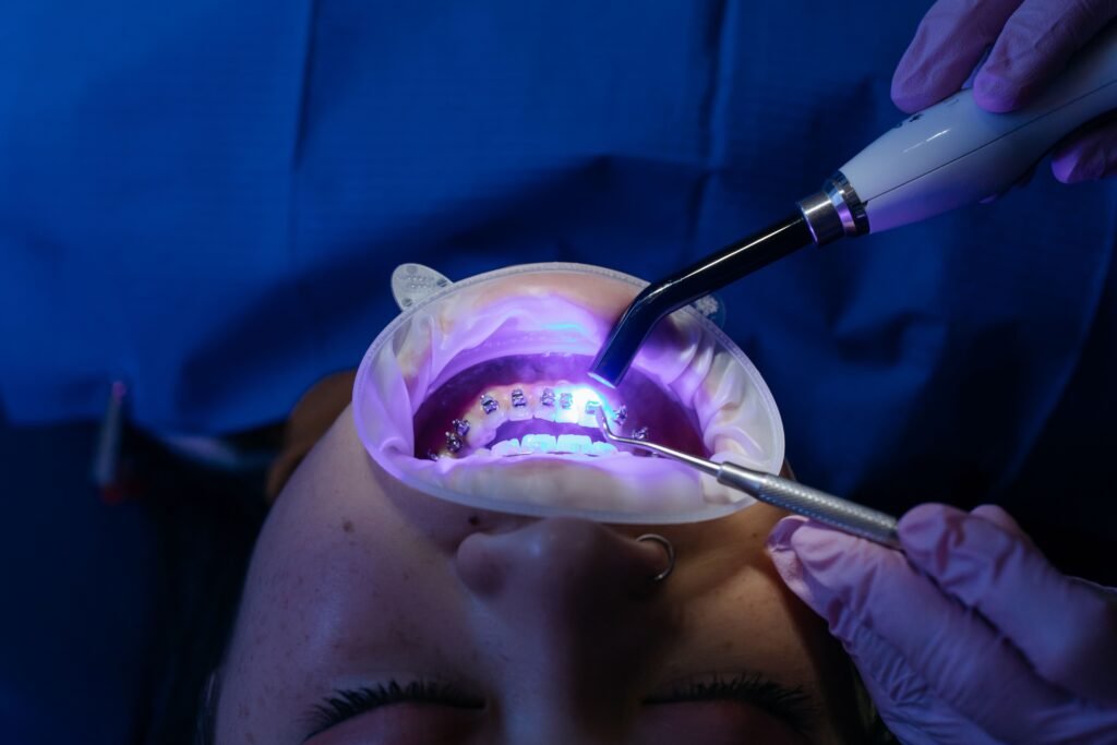 Dental Braces