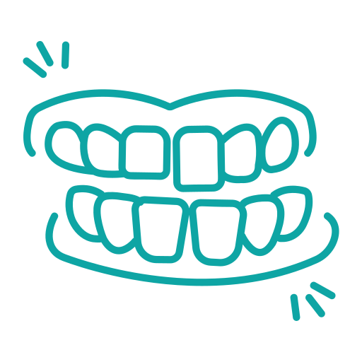Clear Aligners
