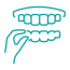 Clear Aligners